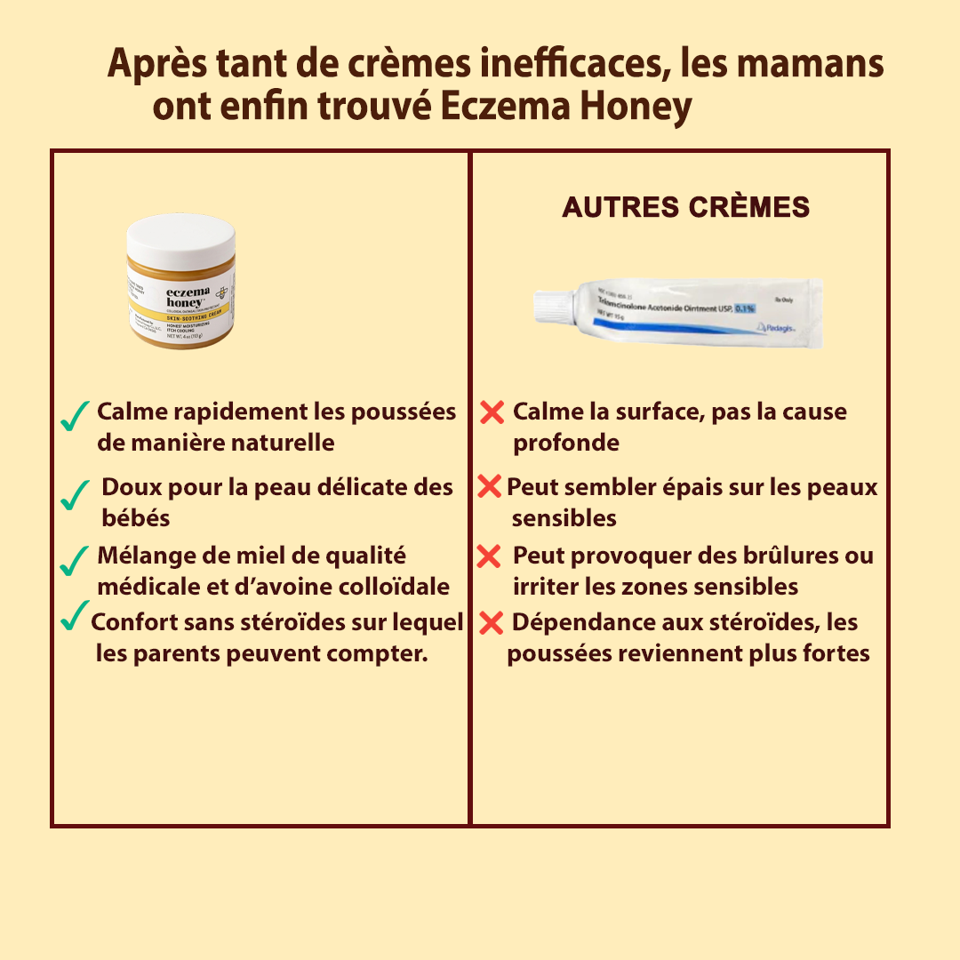 Solution douce et efficace pour apaiser l'eczéma