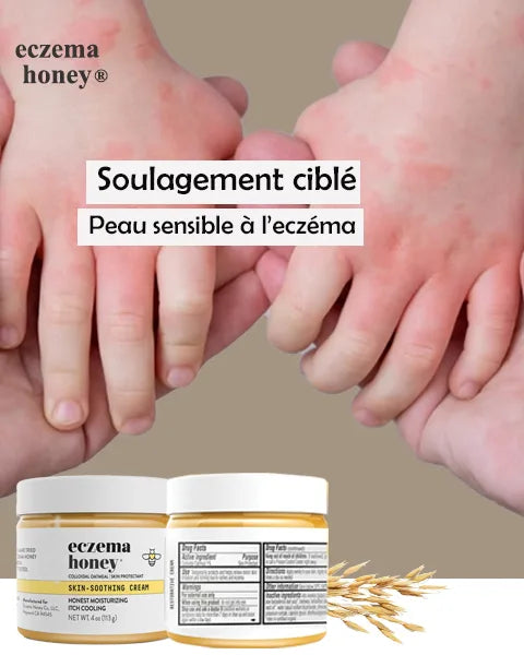 Solution douce et efficace pour apaiser l'eczéma