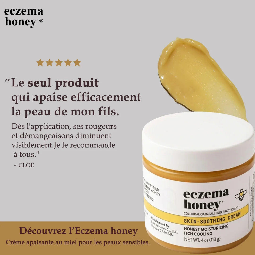 Solution douce et efficace pour apaiser l'eczéma